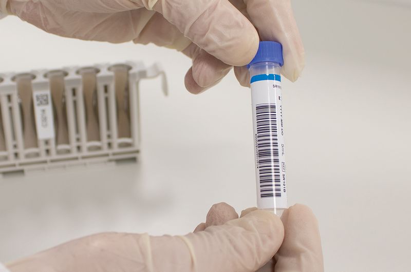Multichem Infectious Disease barcoded QC